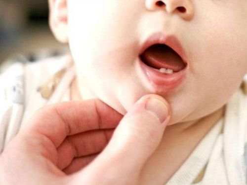 Order of baby teeth eruption - What you need to know