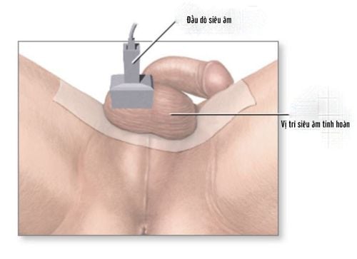 
Siêu âm tinh hoàn là phương pháp cận lâm sàng an toàn và không gây đau đớn
