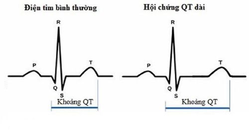 Acquired long QT syndrome update