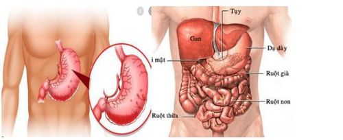 
Hình 1: Dạ dày nằm ở phần bụng trên, hơi lệch sang trái
