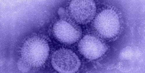 
Tác nhân gây cúm virus Influenza cúm typ A H1N1
