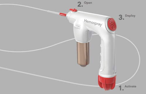 
Hình 8: Bộ dụng cụ Hemospray sau khi lắp hoàn chỉnh (Nguồn: hemospray.cookmedical.com)
