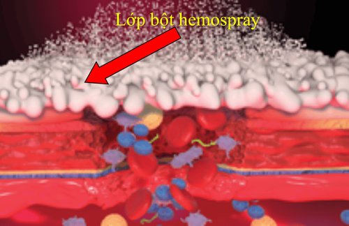 
Hình 9. Bột hemospray tạo một lớp bảo vệ bên ngoài vết thương mạch máu (Nguồn:hemospray.cookmedical.com)
