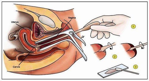 
Hình ảnh lấy bệnh phẩm làm xét nghiệm
