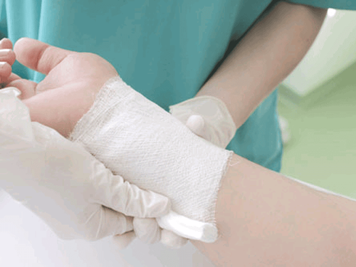 Procedure for changing the dressing of a burn wound