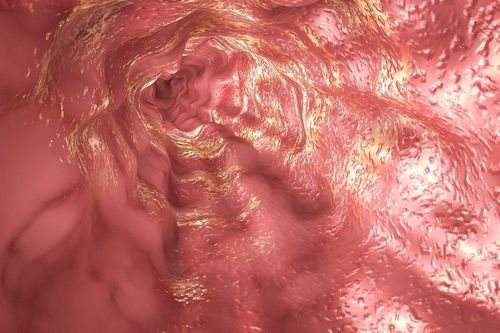 Similarities and differences between PPI-responsive esophageal eosinophilia and eosinophilic esophagitis