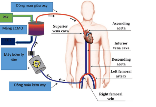 
Hình 1: Sơ đồ nguyên lý máy ECMO
