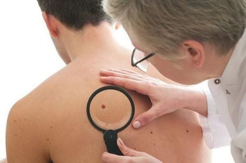 Skin cancer patients now have more treatment options