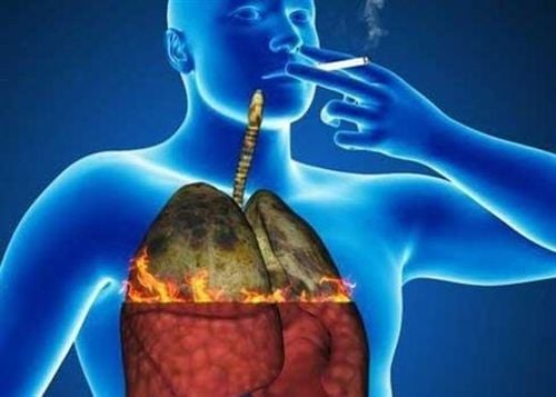 2 main classifications of primary lung cancer