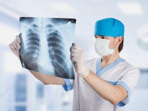 Sự khác nhau giữa chụp CT phổi liều thấp và X - quang thường quy