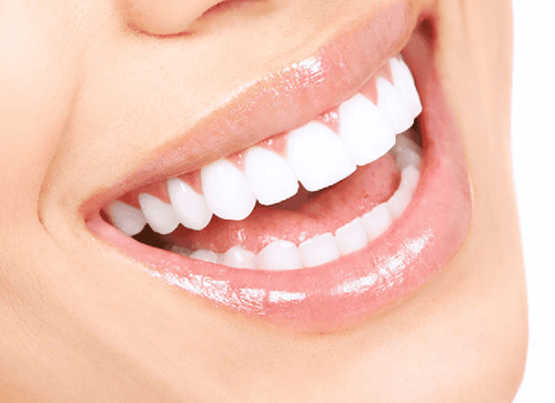 Can porcelain teeth be whitened?