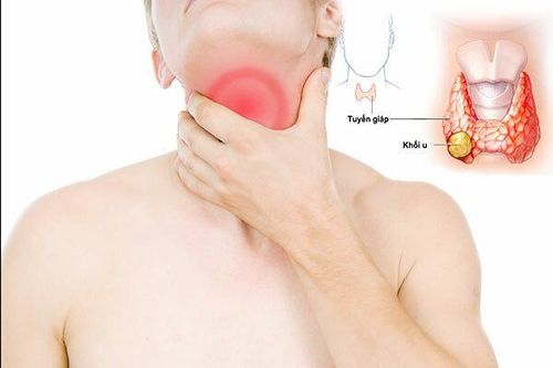 
Trẻ có vấn đề tuyến giáp sẽ có nguy cơ bị lùn
