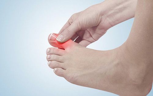 Implants only treat gout