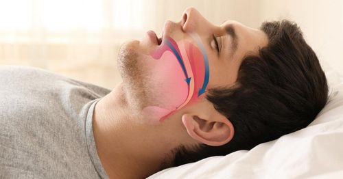 7 nguy cơ tiềm ẩn của chứng ngưng thở khi ngủ do tắc nghẽn