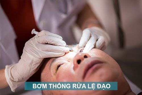 
Bơm thông rửa lệ đạo
