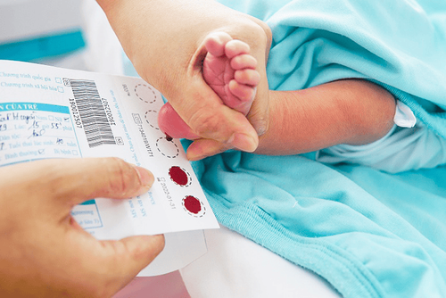 Close-up of heel blood sampling test to diagnose 58 congenital diseases