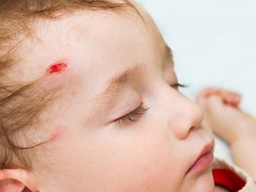 What to do when an infant or toddler falls and hits the head?