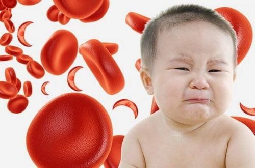 Chỉ số HGB trẻ 8 tháng là 103 có bị thiếu máu không?