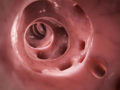 Distribution of colonic diverticulum location