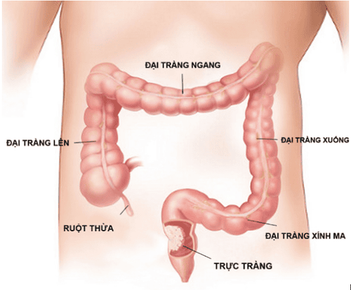 
Cấu tạo của đại trực tràng
