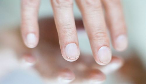 Inflammatory nail disease: What you need to know