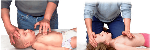 
Thực hiện CPR khi trẻ bị nghẹt thở
