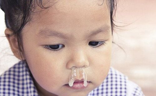 Bé 3 tuổi nghẹt mũi, sưng và VA uống thuốc không đỡ phải làm thế nào?