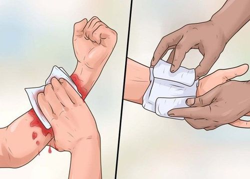 Instructions for first aid for bleeding wounds by pressing and dressing the wound