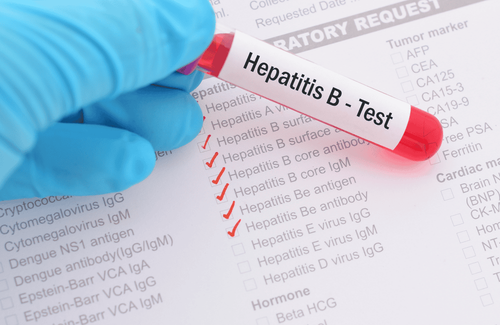 Xét nghiệm Anti HBs dương tính có phải tiêm vắc xin viêm gan B không?