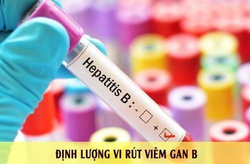 Kết quả định lượng virus viêm gan B giảm thì nên điều trị như thế nào?