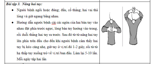 Bài tập phục hồi chức năng sau điều trị ung thư vú