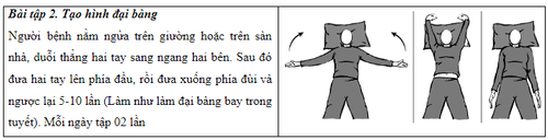 Bài tập phục hồi chức năng sau điều trị ung thư vú