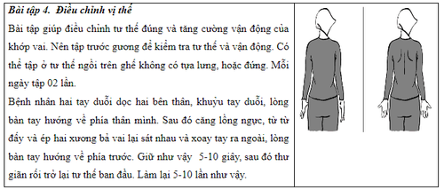 Bài tập phục hồi chức năng sau điều trị ung thư vú