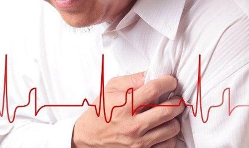 Or heart attack, shortness of breath, fatigue, is myocardial ischemia?