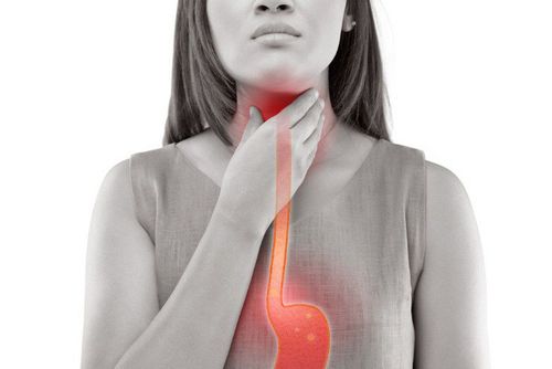 Laryngeal disease due to gastroesophageal reflux