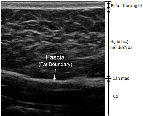 
Hình 3: Các lớp của da trên hình ảnh siêu âm
