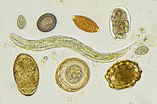 Diagnostic test for roundworm infection