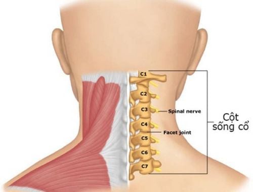 Cánh tay không giơ lên được yếu do thoái hóa đốt sống cổ C5 và gai điều trị thế nào?