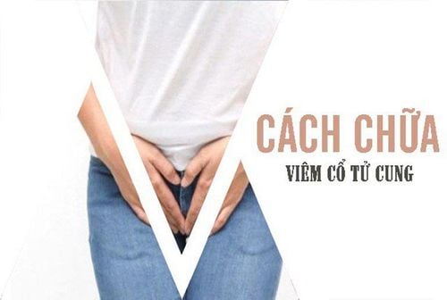 Làm sao để chữa bệnh viêm cổ tử cung?