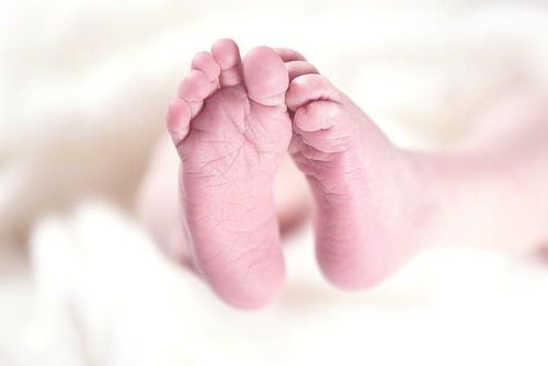 Early intervention of internal lateral lateral foot in infants