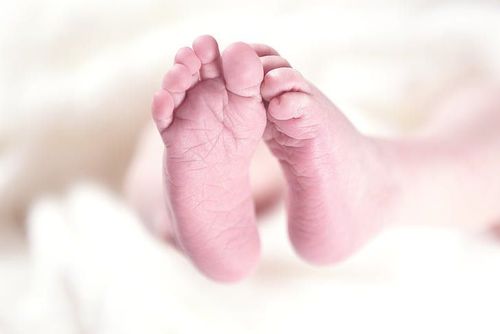 Can thiệp sớm bàn chân nghiêng trong ở trẻ sơ sinh