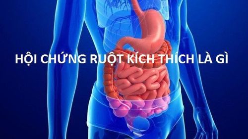 
Hội chứng ruột kích thích còn được gọi là bệnh đại tràng co thắt.