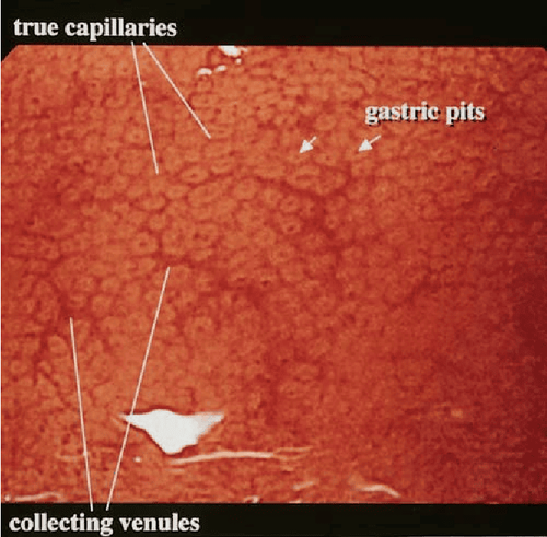 
Hình ảnh minh họa các hố dạ dày (Gastric pit)
