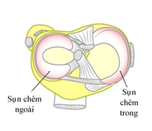 
Khớp gối bình thường
