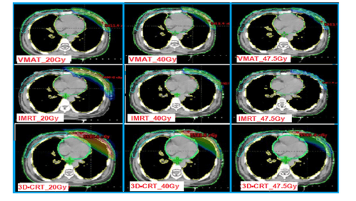 
Hình 4. Phân bố liều trên PTV ở 20Gy, 40Gy, 47.5Gy của 3 kỹ thuật xạ trị

