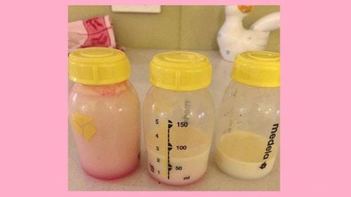Sữa mẹ có màu hồng nhạt sau sinh 4 tháng có sao không?