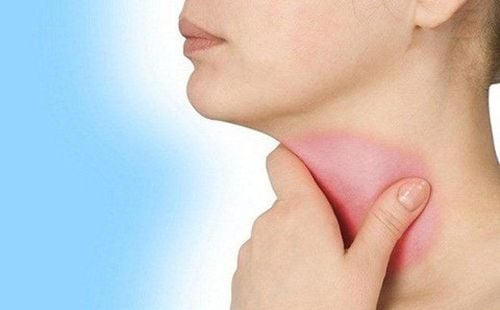 
FDA cũng tiếp tục đánh giá mối liên quan có thể có của bisphosphonates với ung thư thực quản
