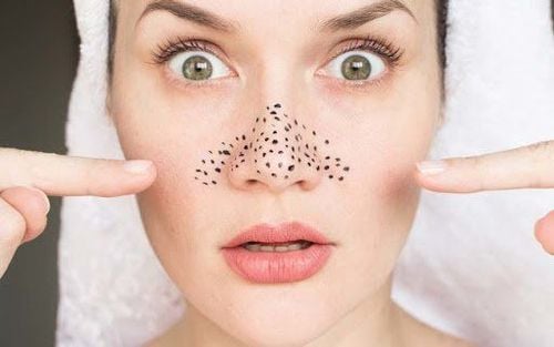 How to remove blackheads from nose at home simple but effective