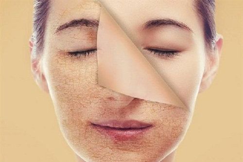 How to safely exfoliate for each skin type