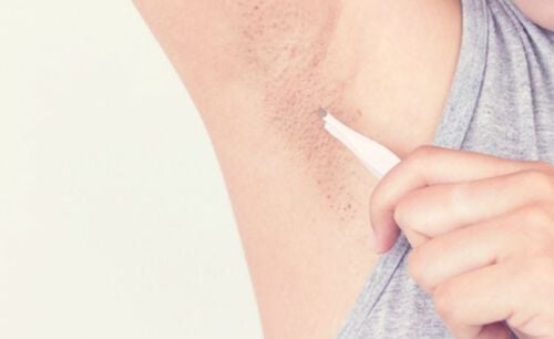 What is ingrown armpit hair?